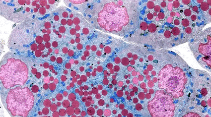 Imagen: Microfotografía electrónica de transmisión (TEM) a color de un corte a través de una reunión de células acinares secretoras de enzimas de un páncreas (Fotografía cortesía de MedImage).